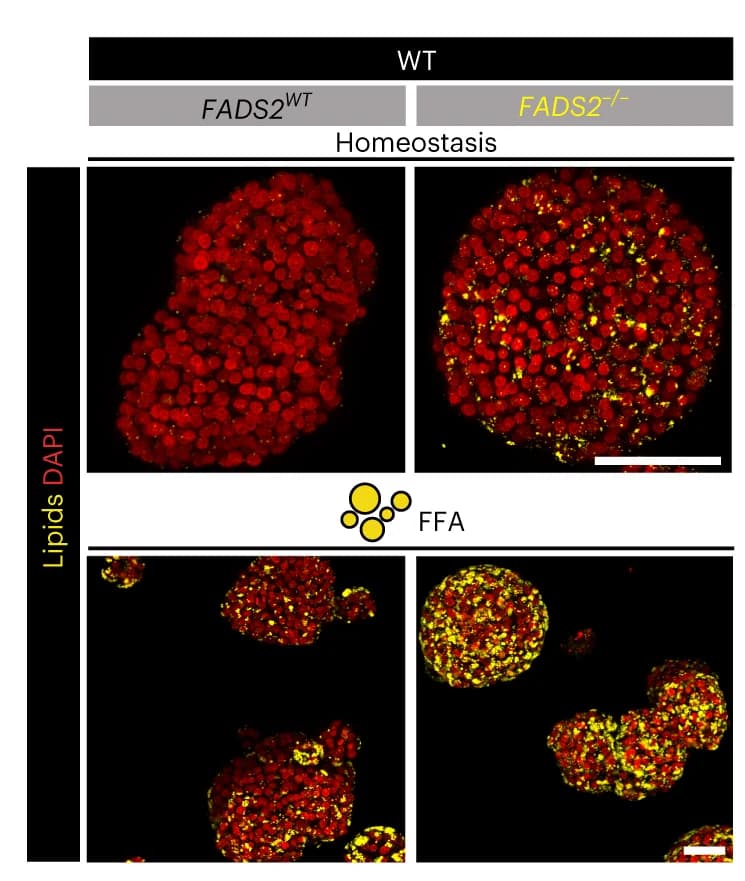 Open access visualization of Microscopy, Nile Red Lipid Staining, FADS2 WT, Organoids, Homeostasis