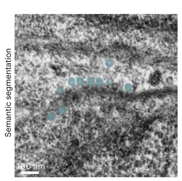 Open access visualization of Microscopy, TEM Micrographs, EMcapsulin Particles, Gap Junctions, Anti-GFP Intrabody
