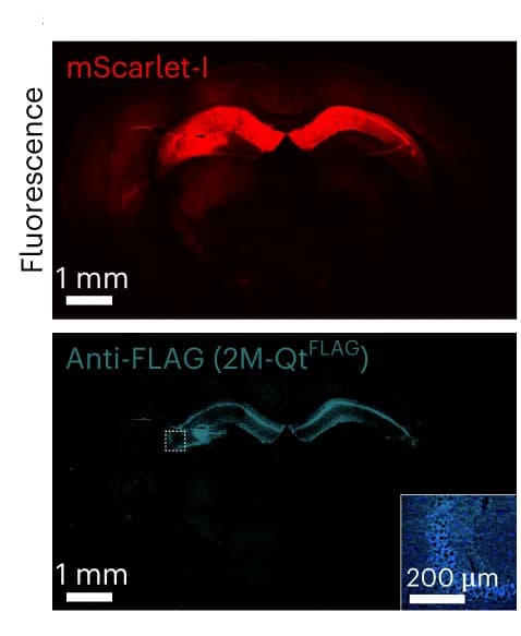 Open access visualization of Microscopy, Confocal Fluorescence Imaging, Coronal Section, Mouse Brain, AAV Transduction