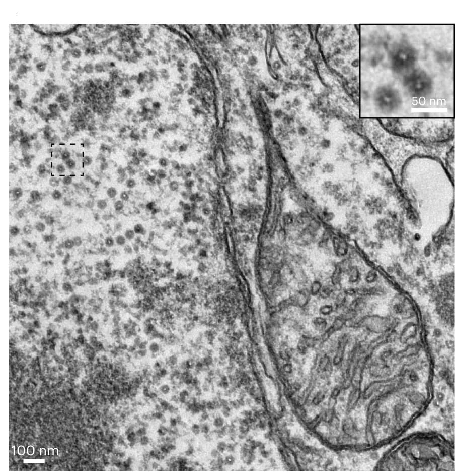 Open access visualization of Microscopy, TEM Micrograph, EMcapsulins, Magnification