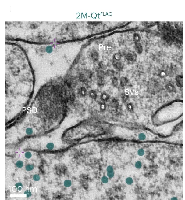 Open access visualization of Microscopy, EMcapsulins, Neuronal Processes, Semantic Segmentation, Membrane Discontinuities