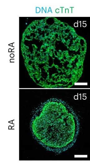 Open access visualization of Microscopy, Immunostaining, CM marker, Spheroids