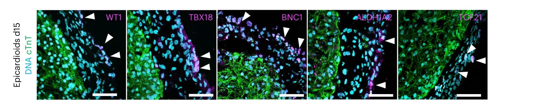 Open access visualization of Microscopy, Immunostaining, Epicardial Markers, Spheroids, Epicardioids