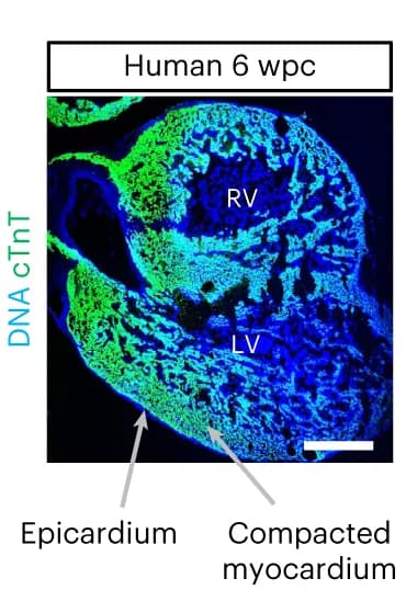 Open access visualization of Microscopy, Immunostaining, Ventricular Tissue, Right Ventricle, Left Ventricle