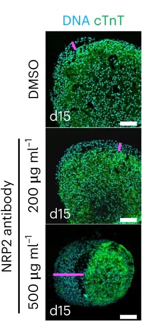 Open access visualization of Microscopy, Immunostaining, cTnT, Epicardioids