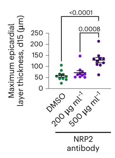 Open access visualization of Scatter Plot, Epicardium thickness, Epicardioids, Statistical analysis, ANOVA