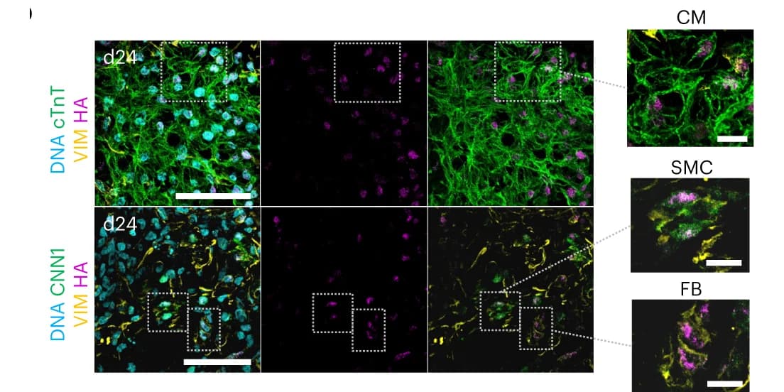 Open access visualization of Microscopy, Immunostaining, HA Tag, CM Marker, cTnT