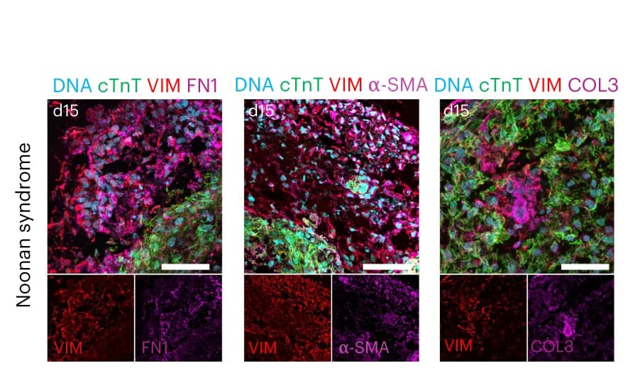 Open access visualization of Microscopy, cTnT, FN1, Alpha-SMA, COL3