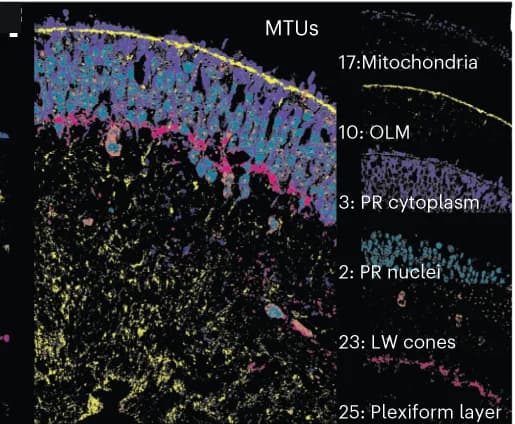 Open access visualization of Microscopy, Mitochondria, OLM, Photoreceptors, LW Cones