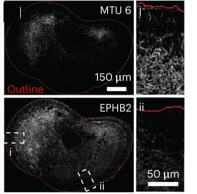 Open access visualization of Microscopy, MTU, EPHB2, Protein Expression, Retinal Organoid