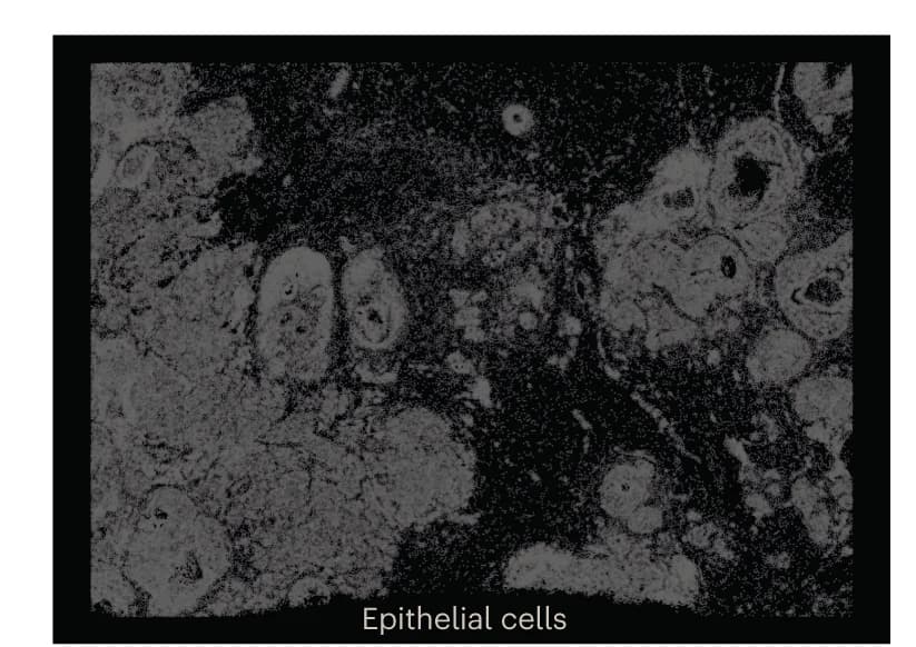 Open access visualization of Microscopy, Spatial Plot, Xenium, Epithelial Cells, IMC