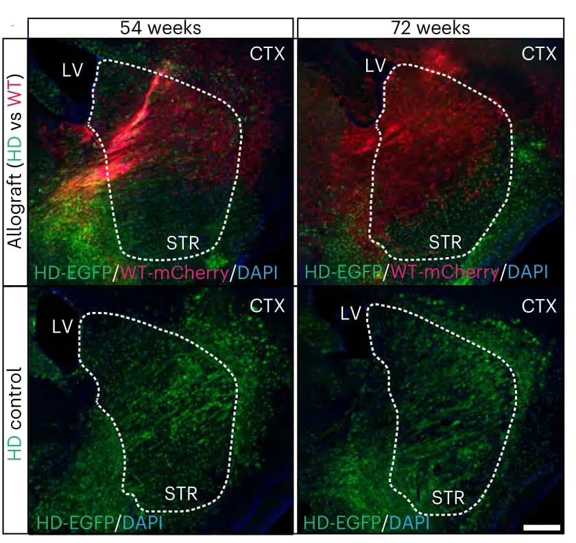 Open access visualization of Microscopy, WT Glia, HD Chimeras, HD Glia, Striatum