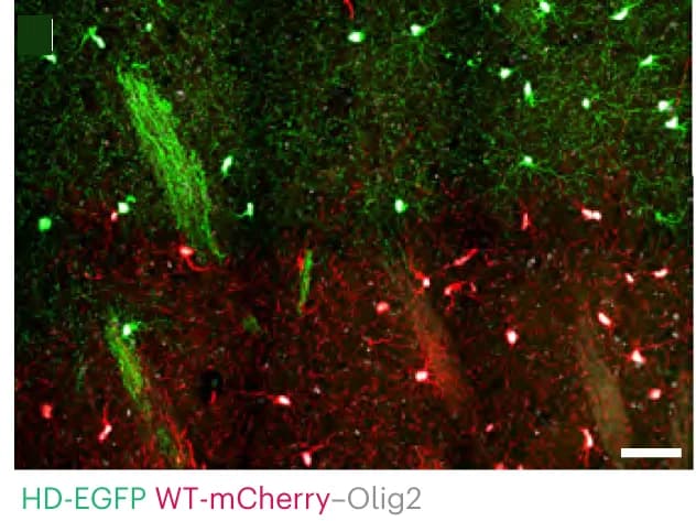 Open access visualization of Microscopy, WT Cells, HD Cells, hGPCs, Olig2