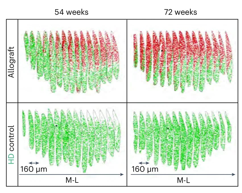 Open access visualization of Microscopy, Striata, Allograft, HD Control