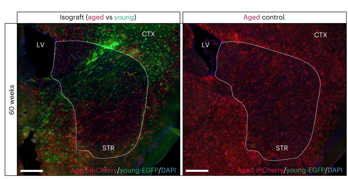Open access visualization of Microscopy, WT Glia, Striatum, WT Chimeras, Human Cells