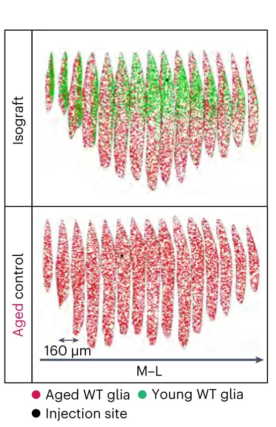 Open access visualization of Microscopy, Striata, Volumetric Quantification, WT Glia, Isogenic Counterparts