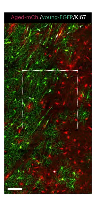 Open access visualization of Microscopy, Young WT Glia, Aged WT Glia, Ki67+ Cells, Interface