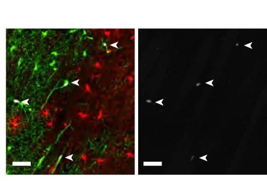 Open access visualization of Microscopy, Ki67+ Cells, Color Split