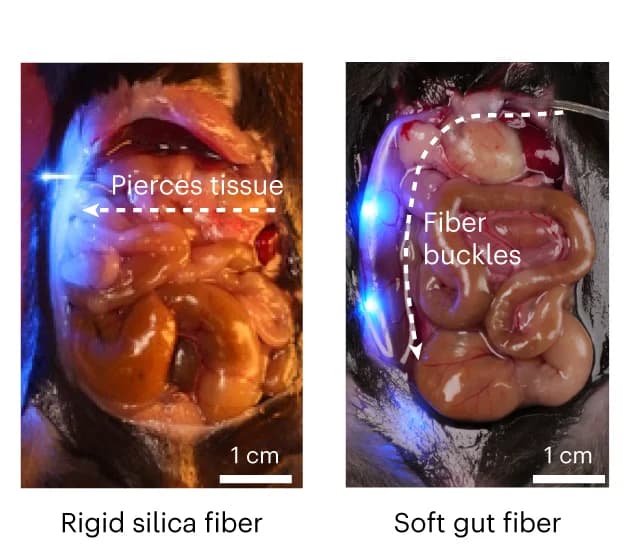 Open access visualization of Photo, Intraluminal Implantation, Silica Fiber, Intestinal Tissue, Gut Fiber