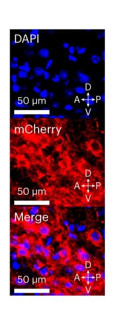 Open access visualization of Microscopy, Cre-dependent ChR2-mCherry construct, Microfluidic AAV5 delivery, DAT::Cre Mice, VTA