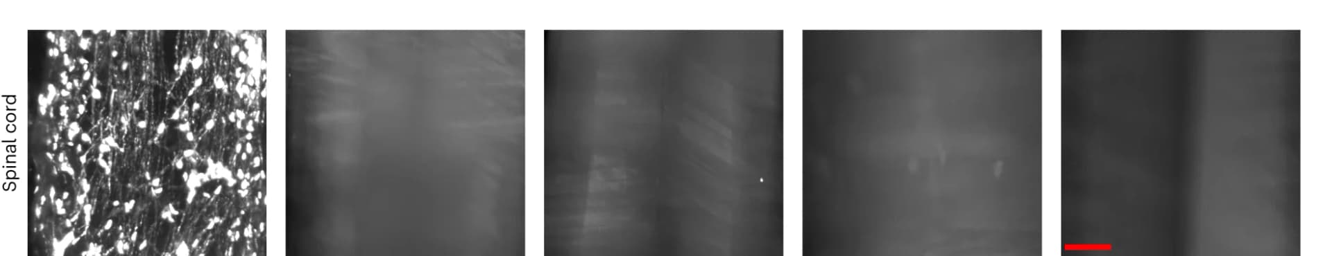 Open access visualization of Microscopy, 2D Optical Images, Spinal Cord, wildDISCO, vDISCO
