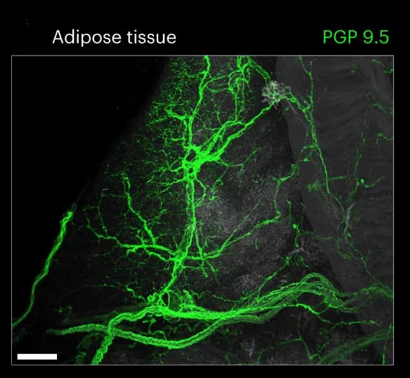 Open access visualization of Microscopy, Innervation, Adipose Tissue