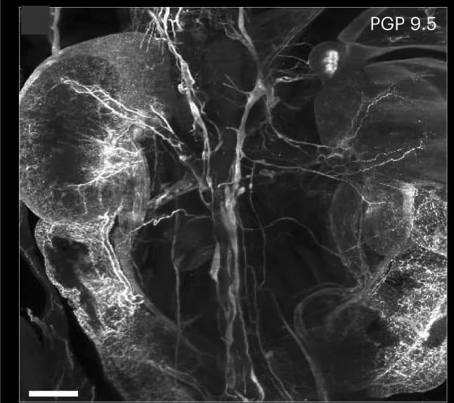 Open access visualization of Microscopy, PGP 9.5, Nerve Innervation, Organs