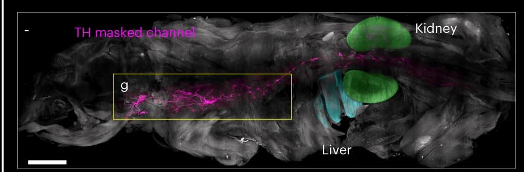 Open access visualization of Microscopy, TH, Vagus Nerve, Spinal Cord, Neck