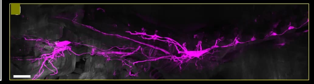 Open access visualization of Microscopy, Vagus Nerve, Mouse
