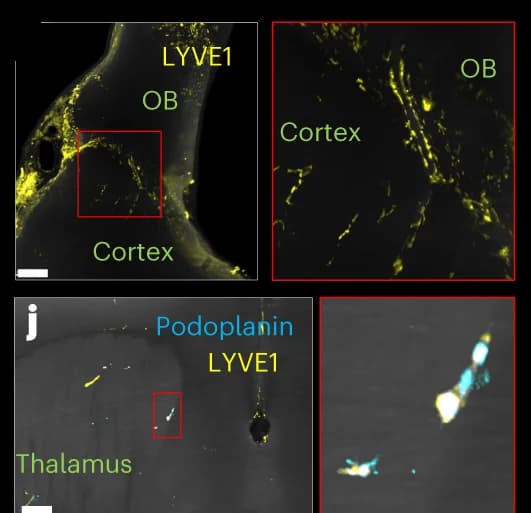 Open access visualization of Microscopy, Lymphoid Elements, LYVE1, Brain Parenchyma, Mouse
