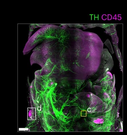 Open access visualization of Microscopy, Mouse, TH, CD45, Neuro-immune interactions