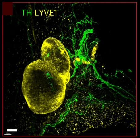 Open access visualization of Microscopy, Optical Sections, Hindlimb Lymph Nodes, TH, LYVE1