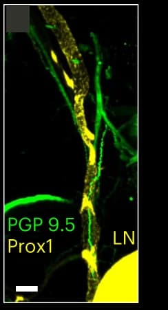 Open access visualization of Microscopy, Optical Sections, Hindlimb Lymph Nodes, PGP 9.5, Prox1