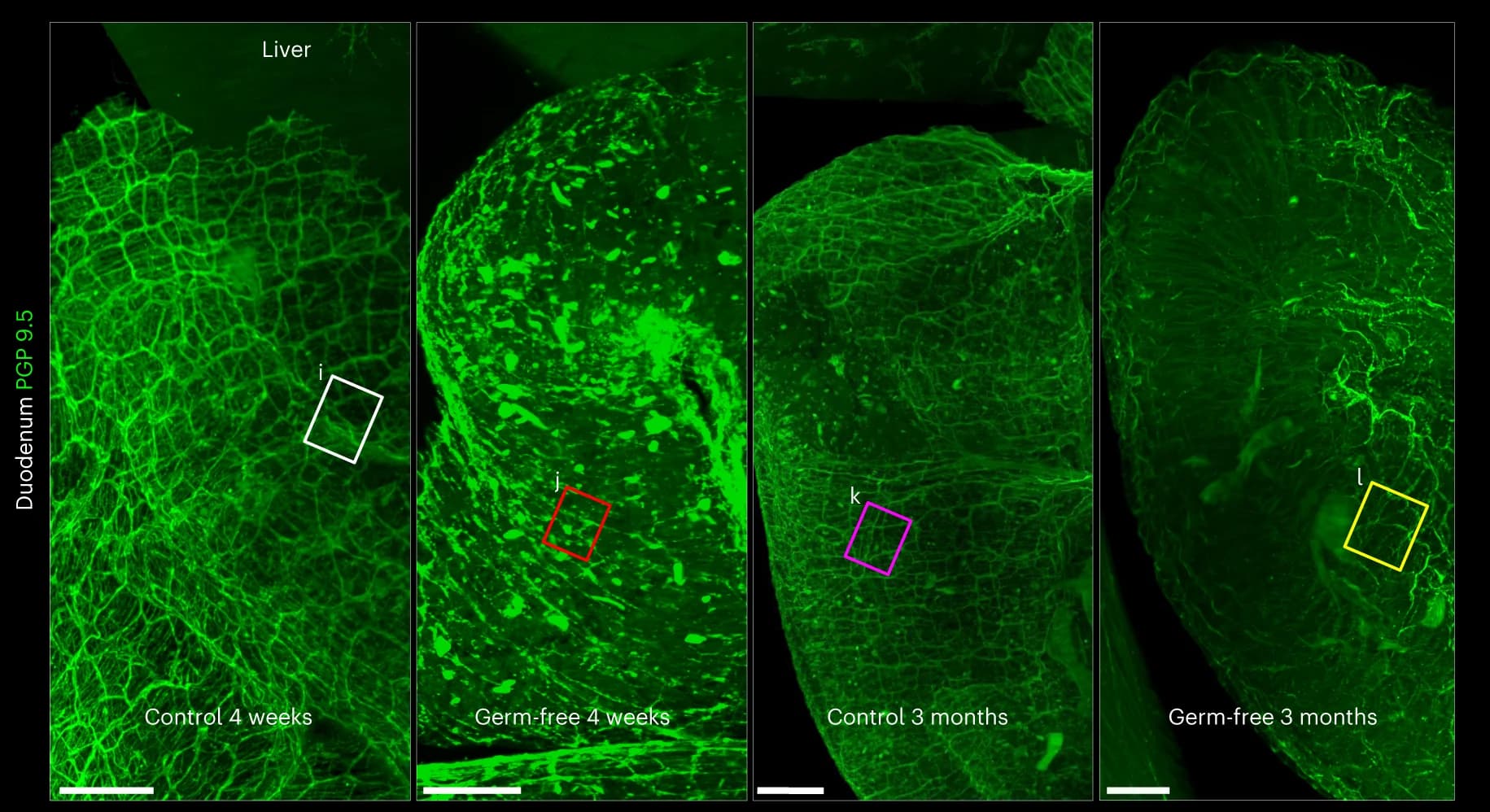 Open access visualization of Microscopy, Enteric Nerve Lattice Network, Wildtype Mice, Germ-free Mice, PGP 9.5