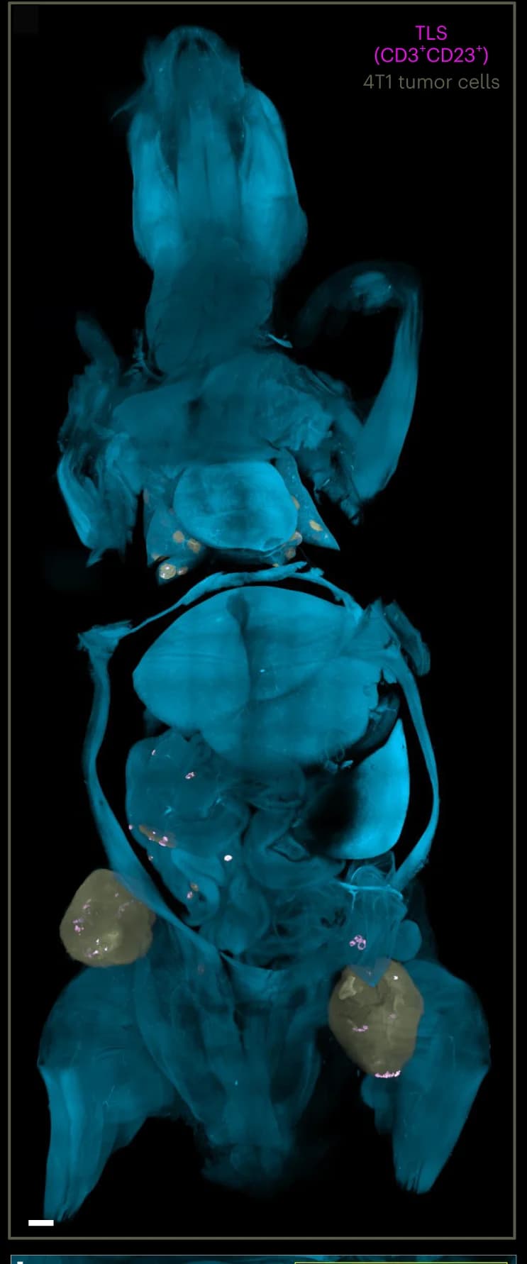 Open access visualization of Microscopy, 3D Rendering, Mouse, 4T1 Cell Metastases, Light-Sheet Microscopy