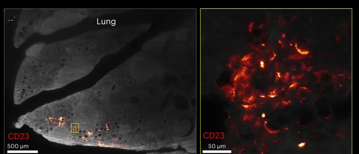 Open access visualization of Microscopy, Photo, TLS, Mouse, Tumors