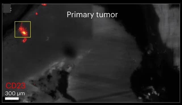 Open access visualization of Microscopy, TLS, Mouse, Tumors, CD23