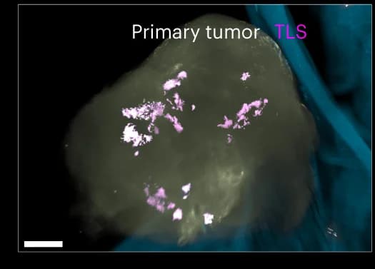 Open access visualization of Microscopy, Photo, TLS, Primary Tumor, Masking