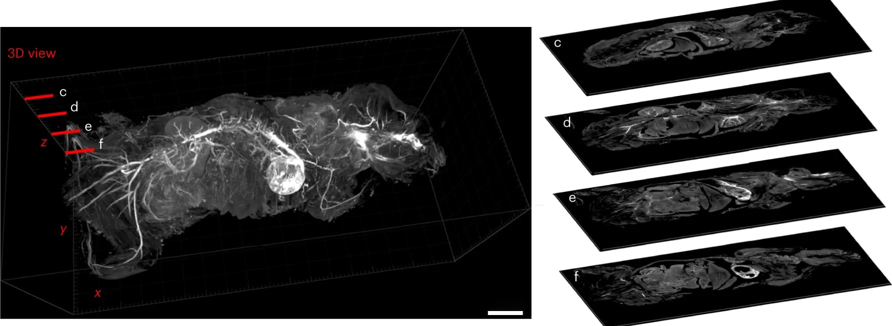 Open access visualization of 3D Plot, Whole-body Atlas, 3D View