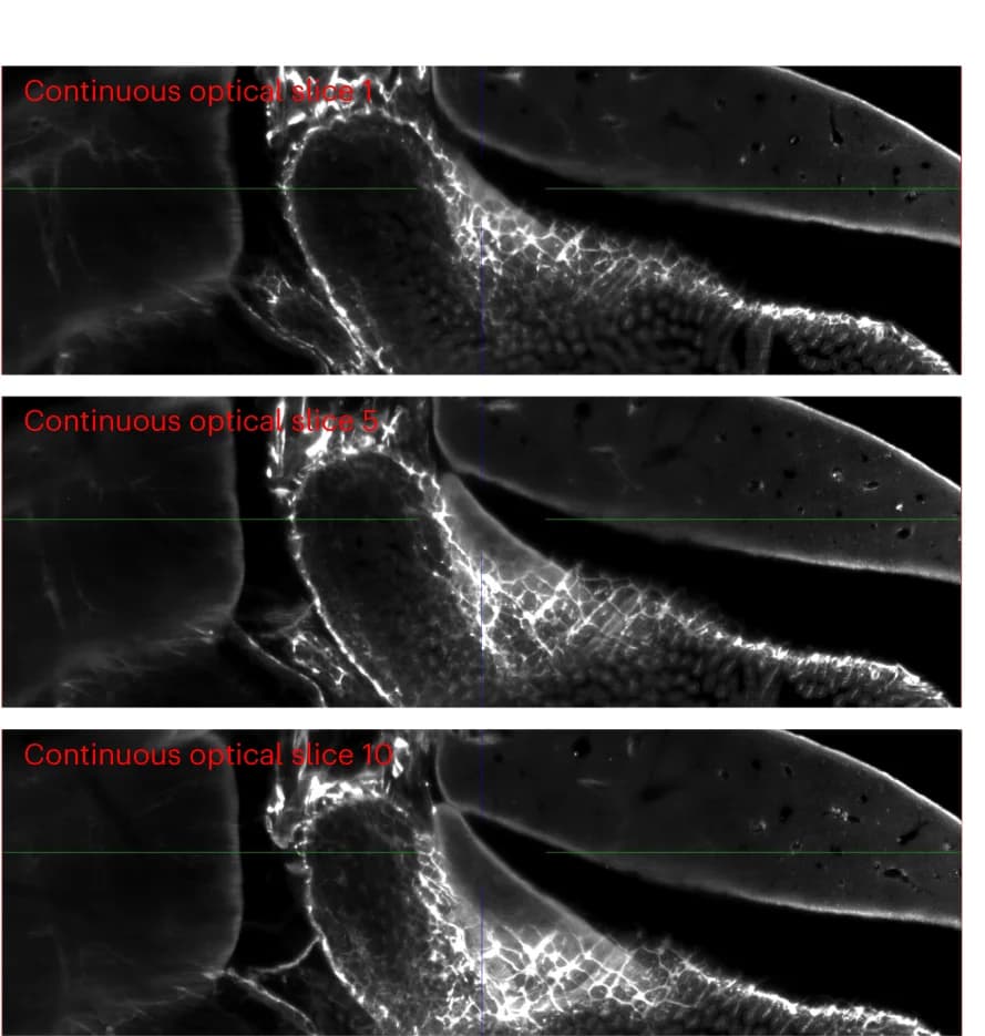 Open access visualization of Microscopy, Optical Sections