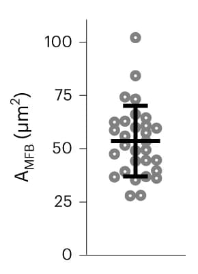 Open access visualization of Scatter Plot, Error Bars, Surface Area, A MFB