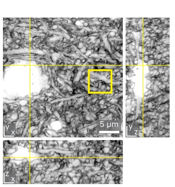 Open access visualization of Microscopy, coCATS imaging, z-STED, Neuropil, Hippocampal Brain Slice