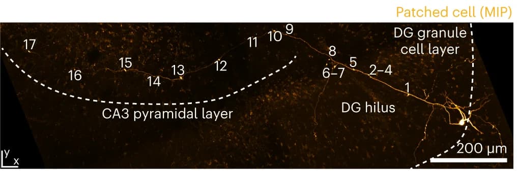 Open access visualization of Microscopy, DG Granule Cell, Hippocampal Slice, Mossy Fiber, Axon
