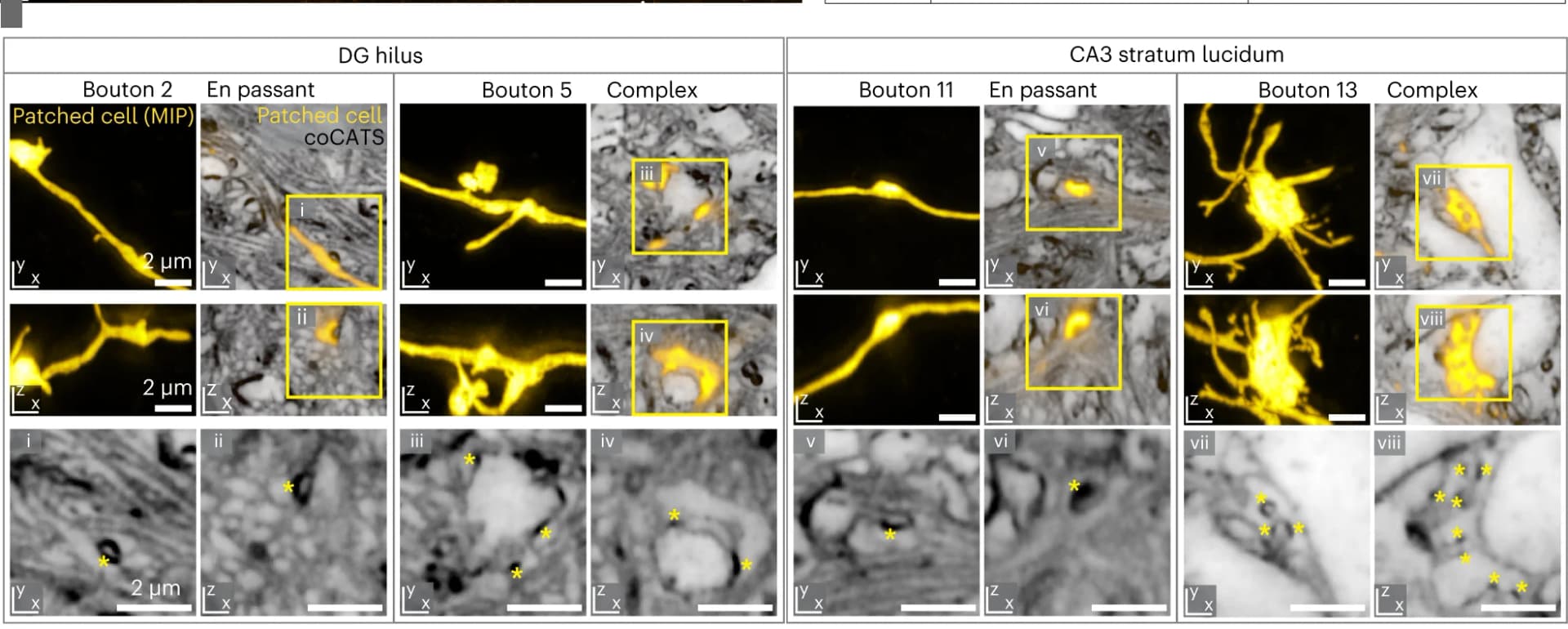 Open access visualization of Microscopy, Synapses, coCATS, Mossy Fiber, pSCRs