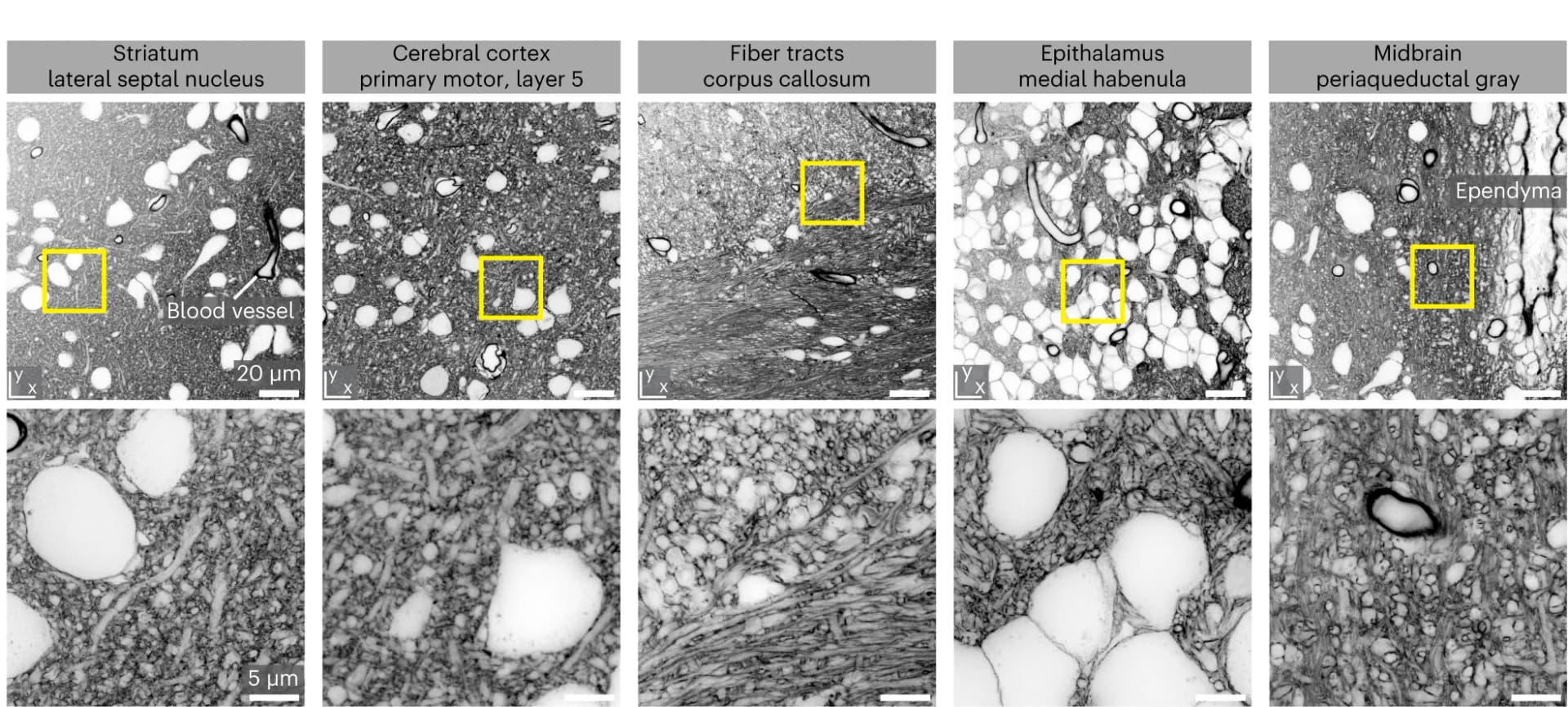 Open access visualization of Microscopy, Brain, coCATS, Cell Bodies, Dendrites