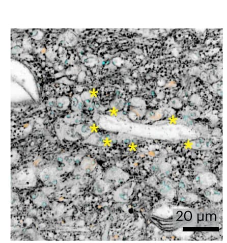 Open access visualization of Microscopy, Dendrite, Mossy Cell, MFBs, SHANK2
