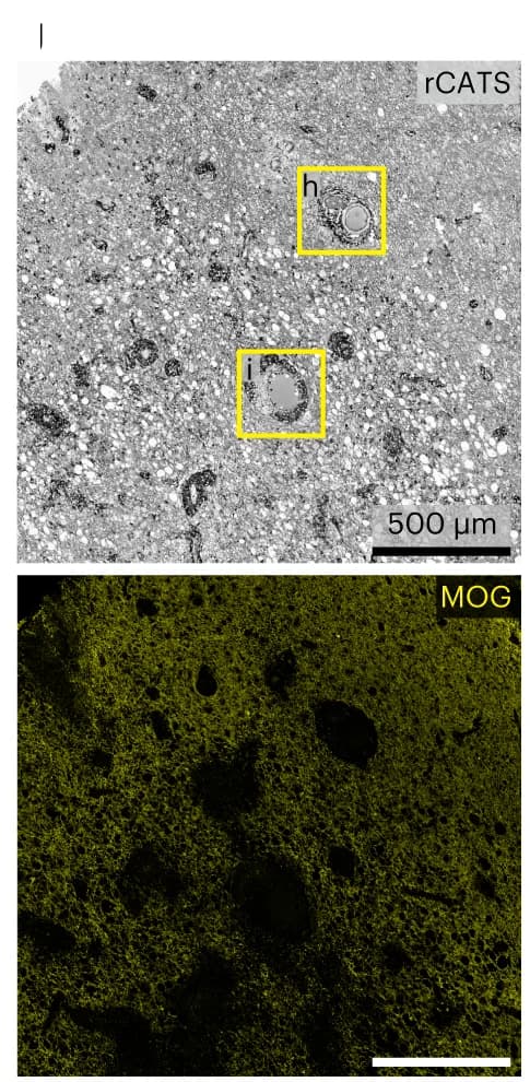 Open access visualization of Microscopy, Confocal, Tissue Edema, Immune Cells, rCATS