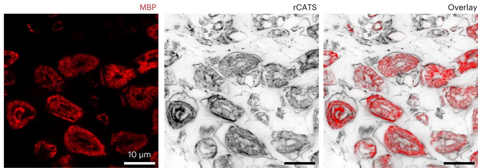 Open access visualization of Microscopy, rCATS, STED, MBP, Confocal