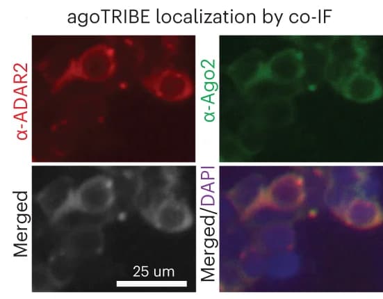 Open access visualization of Microscopy, Immunofluorescence, AgoTRIBE, AGO2, ADAR2