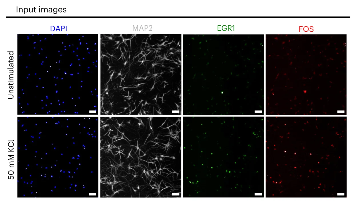 Open access visualization of Microscopy, Immunofluorescent Images, Unstimulated Neurons, KCl, Fixation